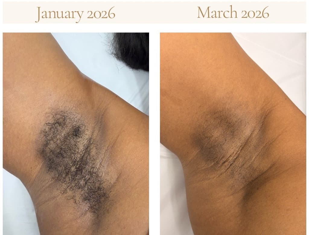 Full-Body Waxing